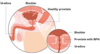 normal size prostate gland grams